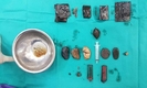 【의학】하노이 한 남성 몸에서 발견된 라이터, 면도날