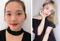 [트렌드] 젊은 사람들, 더 아름다움을 위해 성형