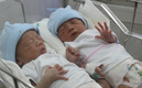 쌍둥이를 갖기 위해 체외수정(IVF)이 인기