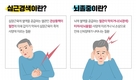 호치민시, 3개월 동안 수백명의 사람들이 뇌졸중으로 입원