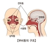 부비동염 환자에게 좋은 음식 5가지